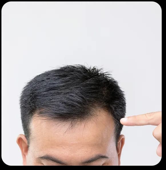 Hair Consultation
